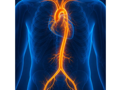 angiografia MRI angiography – scan report