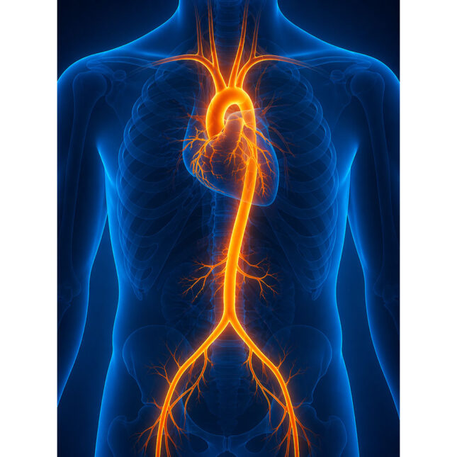 MRI angiography – scan report